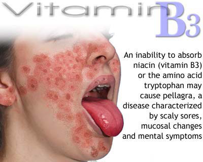 Importance of Vitamins - Awareness Post