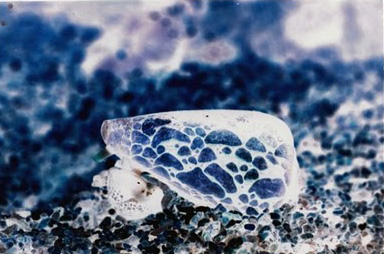 10 Most Poisonous Animals in The World